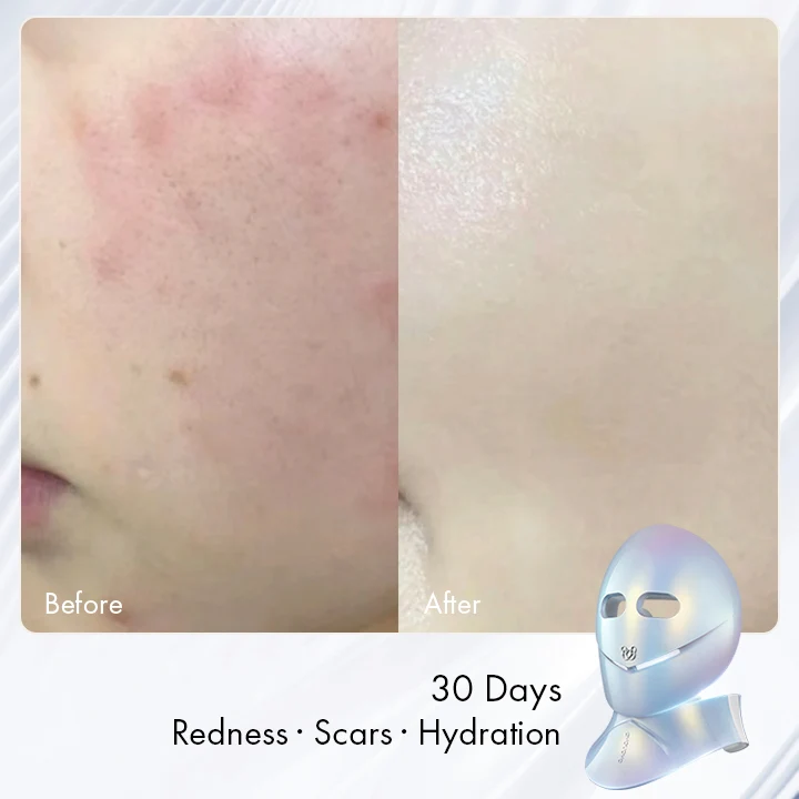 So Sánh Chi Phí Trị Liệu Clinic